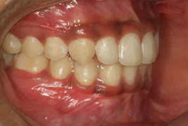 Best Dental Clinic in Bangalore
