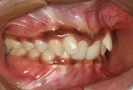Best Dental Clinic in Bangalore