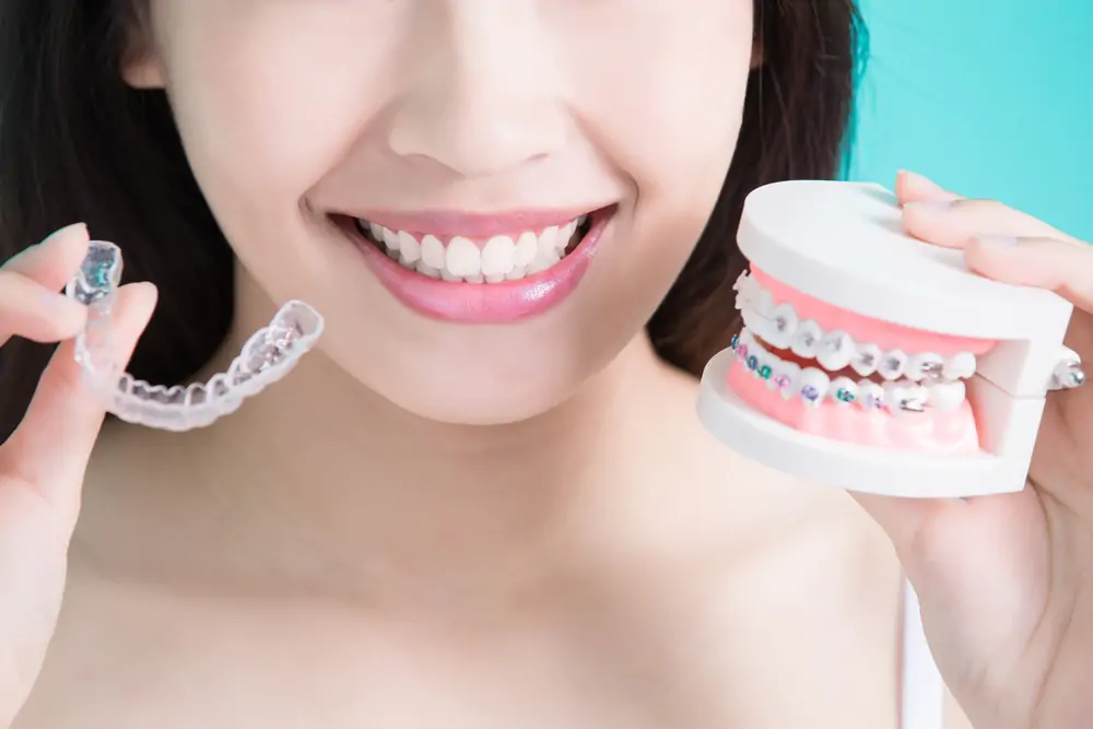 Best Dental Clinic in Bangalore Invisalign Orthodontics in HSR Layout, Bangalore