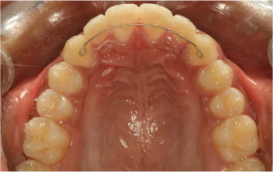 Best Dental Clinic in Bangalore