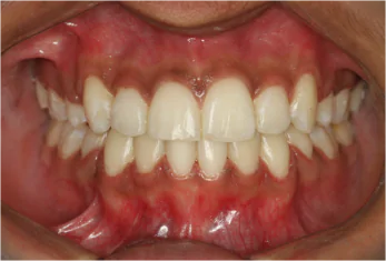 Best Dental Clinic in Bangalore