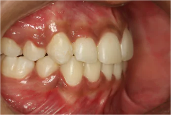 Best Dental Clinic in Bangalore