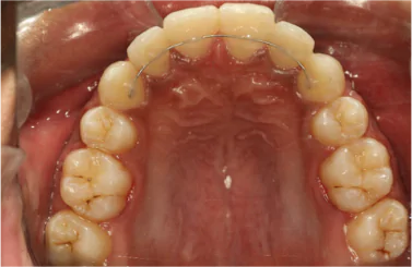 Best Dental Clinic in Bangalore