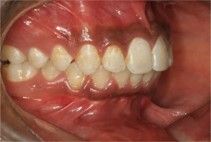 Best Dental Clinic in Bangalore