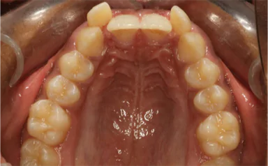 Best Dental Clinic in Bangalore