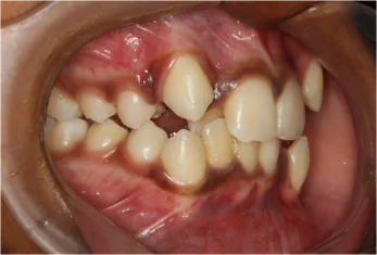Best Dental Clinic in Bangalore