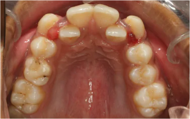 Best Dental Clinic in Bangalore