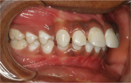 Best Dental Clinic in Bangalore