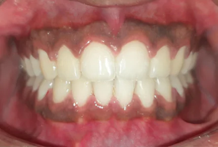 The Best dental clinic in HSR Layout, Bangalore