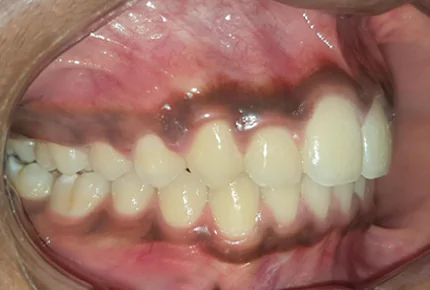 The Best dental clinic in HSR Layout, Bangalore