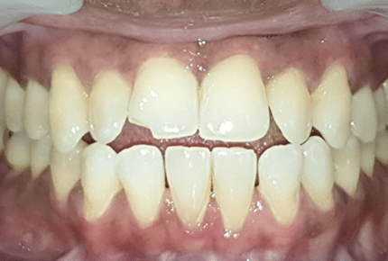 The Best dental clinic in HSR Layout, Bangalore