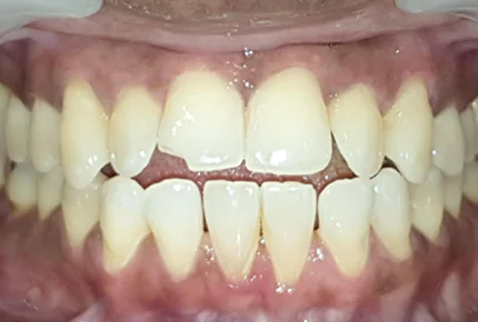 The Best dental clinic in HSR Layout, Bangalore
