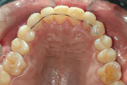 The Best dental clinic in HSR Layout, Bangalore