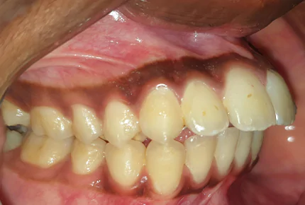 The Best dental clinic in HSR Layout, Bangalore
