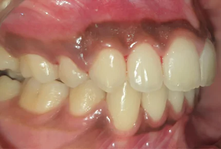 The Best dental clinic in HSR Layout, Bangalore