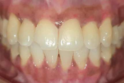 The Best dental clinic in HSR Layout, Bangalore