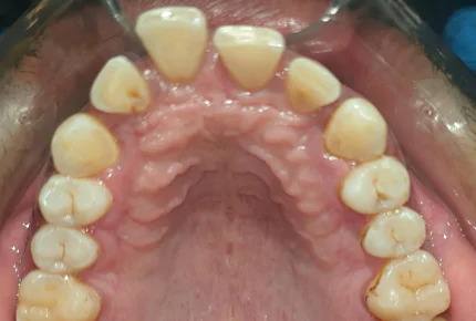 The Best dental clinic in HSR Layout, Bangalore