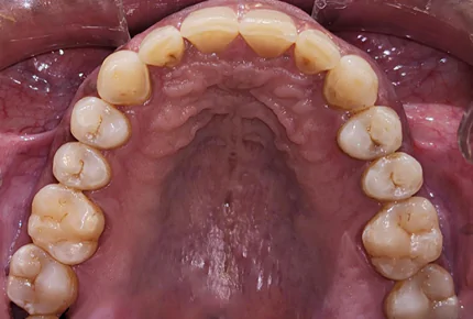 The Best dental clinic in HSR Layout, Bangalore