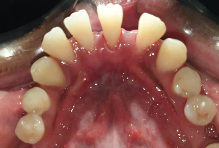The Best dental clinic in HSR Layout, Bangalore