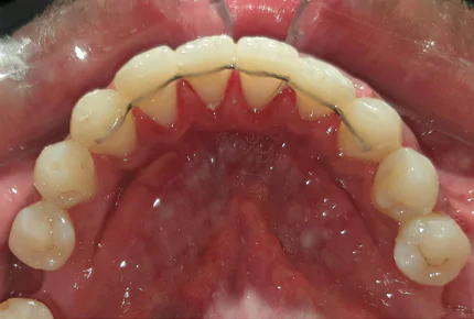 The Best dental clinic in HSR Layout, Bangalore
