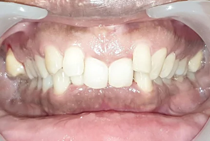 The Best dental clinic in HSR Layout, Bangalore