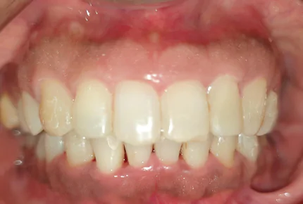 The Best dental clinic in HSR Layout, Bangalore