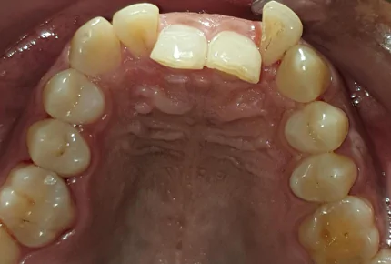 The Best dental clinic in HSR Layout, Bangalore