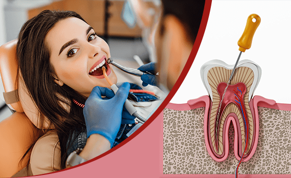 Best Dental Clinic in HSR Layout, Bangalore,
