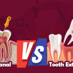 Best Dental Clinic in HSR Layout, Bangalore