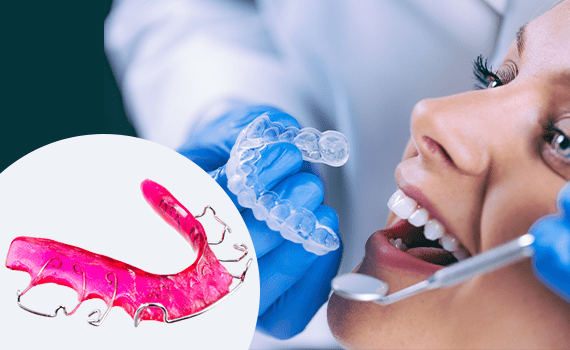 Invisalign Clinic in HSR Layout, Bangalore