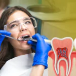 Root Canal Specialist in HSR Layout Bangalore