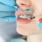 Invisalign Orthodontist in HSR Layout