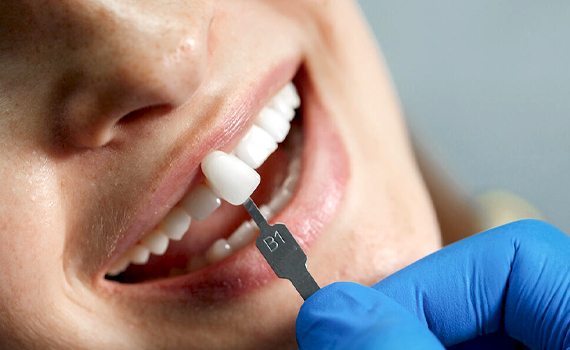 best dental clinic in HSR Layout, Bangalore