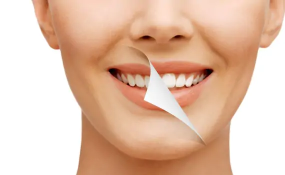 Cosmetic Dental Treatment in HSR Layout