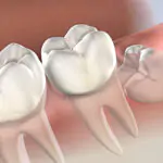 Best Dental Clinic in HSR Layout, Koramangala