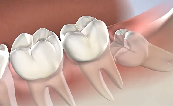 Best Dental Clinic in HSR Layout, Koramangala