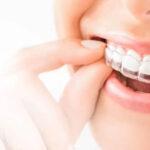 Invisalign orthodontist in HSR Layout, Bangalore