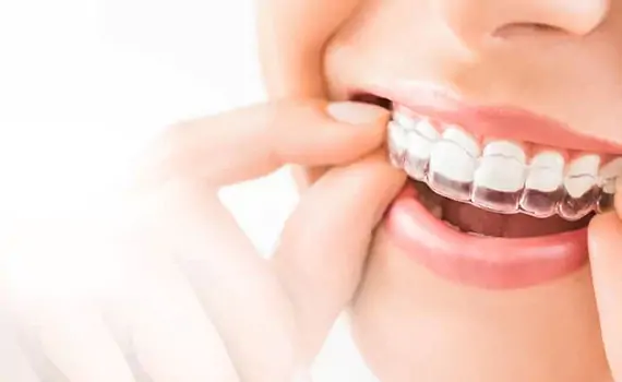 Invisalign orthodontist in HSR Layout, Bangalore