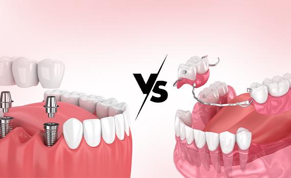 General Dentistry Specialists in HSR Layout, Bangalore