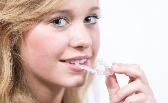 Invisalign Treatment in HSR Layout, Bangalore