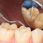 General Dentistry in HSR Layout, Bangalore