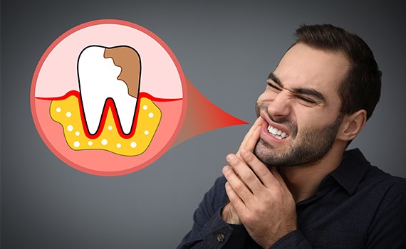 Seeking expert care from a trusted provider like Braceport Dentistry, known as the Best Dental Clinic in HSR Layout, can make all the difference in ensuring early diagnosis and effective treatment.