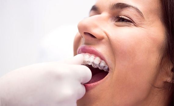 Braceport Dentistry has an Invisalign orthodontist in HSR Layout, Bangalore, to provide personalized treatment plans for each patient based on their unique needs in order to achieve the best result possible using Invisalign.