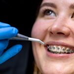 Whether you are already receiving orthodontic treatment or thinking about starting to undergo the procedure, Braceport Dentistry the best dental clinic in HSR Layout, Bangalore is here to guide you through the process and answer all your questions.