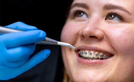 Whether you are already receiving orthodontic treatment or thinking about starting to undergo the procedure, Braceport Dentistry the best dental clinic in HSR Layout, Bangalore is here to guide you through the process and answer all your questions.