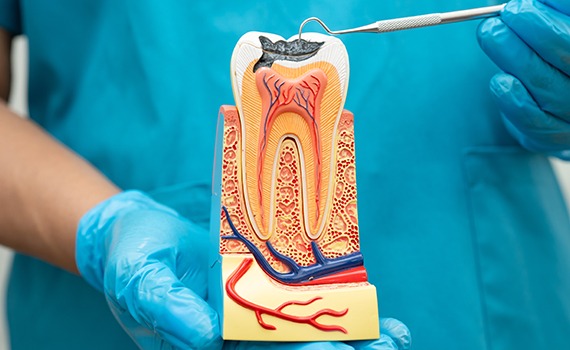 . Timely Root Canal Treatment in HSR layout can help you save your natural tooth, get rid of pain, and save the tooth from spreading infection further.